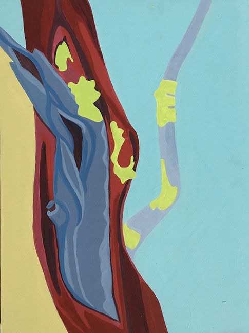 Click here to view Beautiful scar by Denise Gimbel